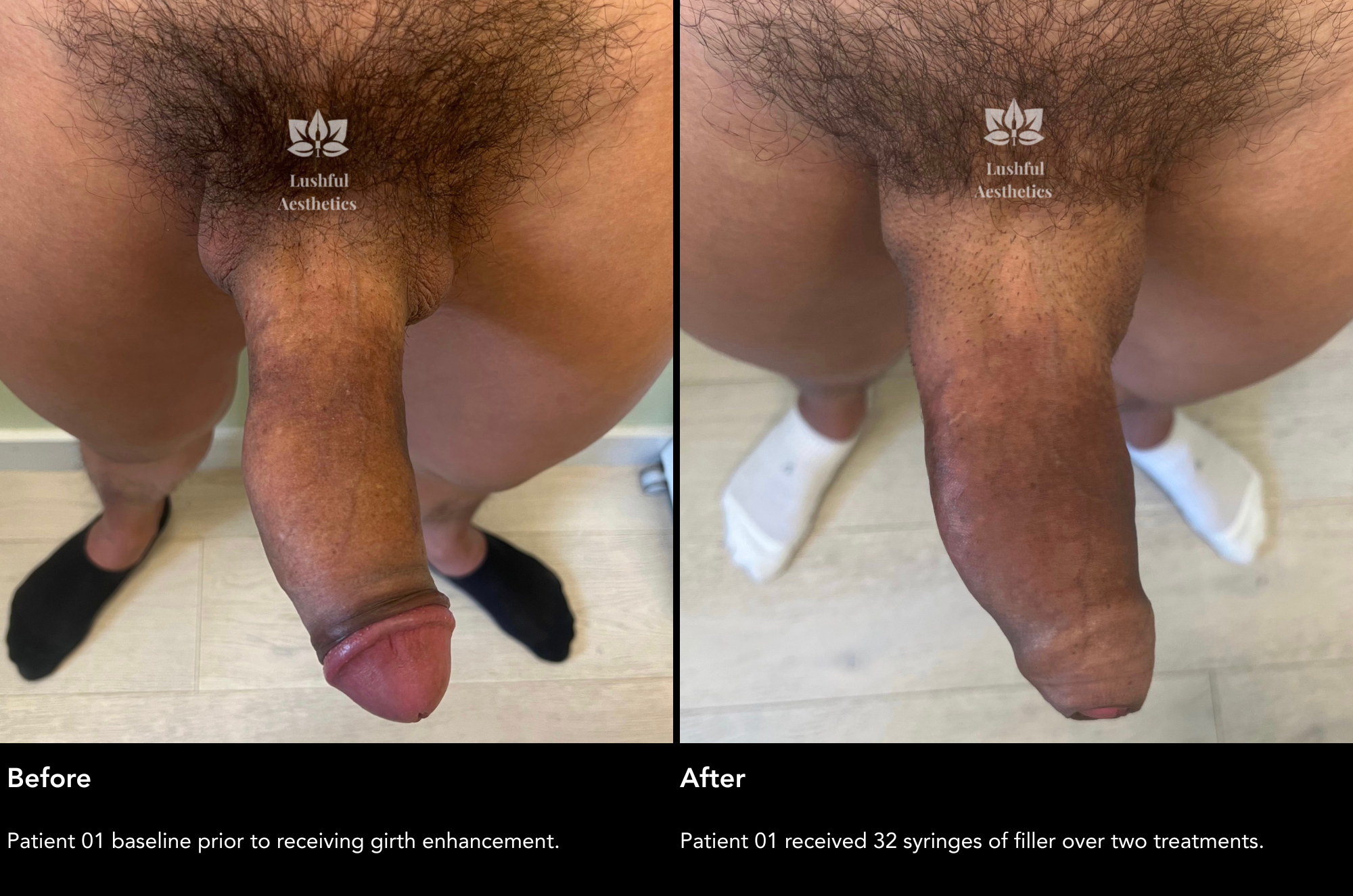 Before and After Case 1