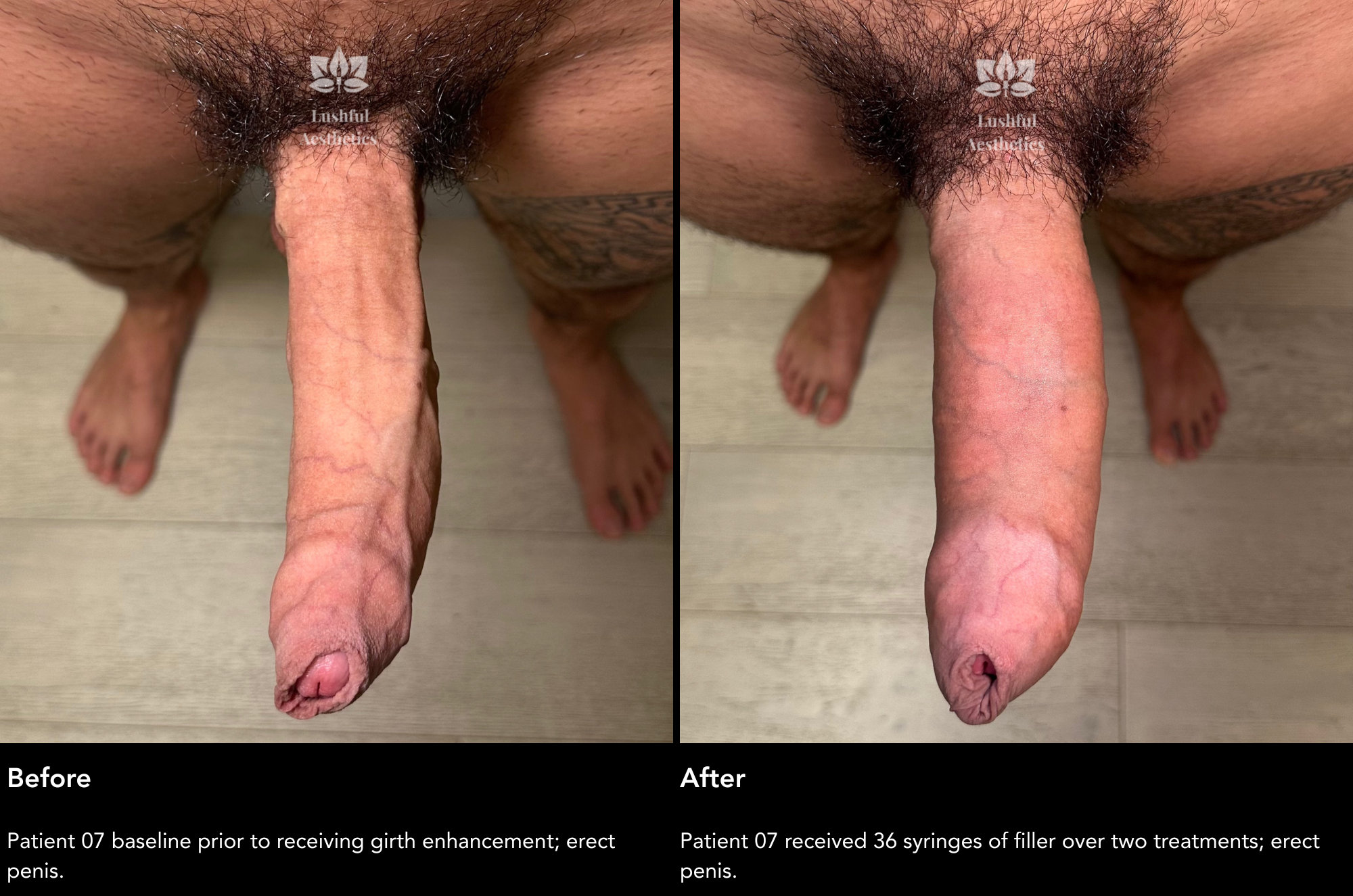 Before and After Case 7